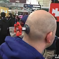 头皮以下高位截瘫头像